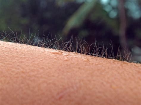The Surprising Reason Why We Get Goosebumps Times Of India