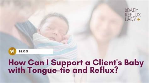 reflux tongue tie   professionals   clients