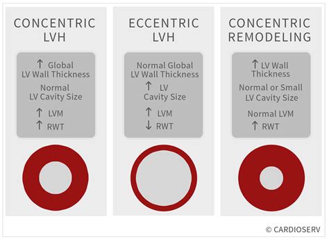 understanding lvh part  concentric eccentric  concentric remodeling cardioserv