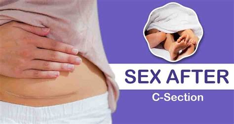 Sex After C Section Everything You Need To Know