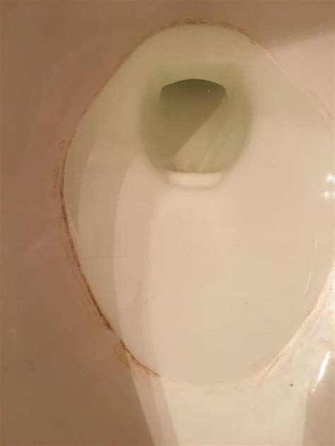 remove  hard water ring      toilet bowl