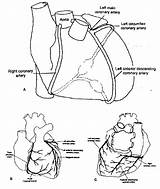 Coronary Artery Heart Infarction Myocardial Mi Anatomy Schematic Acute Left Diagram Complications Disease Location Cardio Ischemic Main Which Courses Bio sketch template