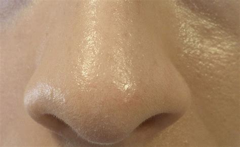 oily skin large pores oily skin community