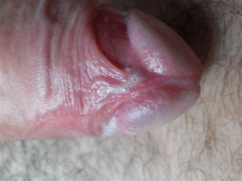 22  In Gallery Close Up Of My Cock Head With Pre Cum