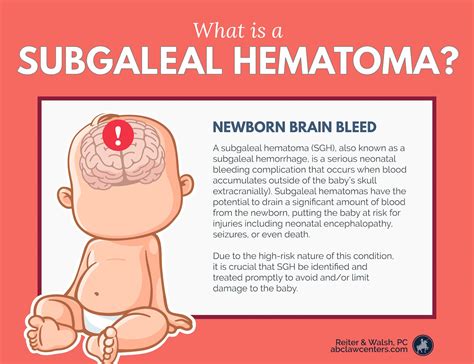 Subgaleal Hemorrhages Brain Bleeds