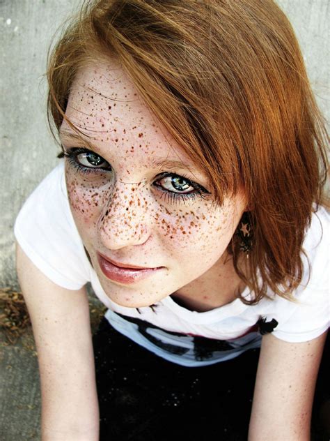 I Think A Few Freckles Can Be Cute But This Is Scary