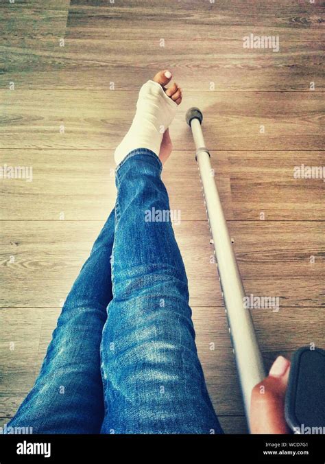 leg  crutch  res stock photography  images alamy