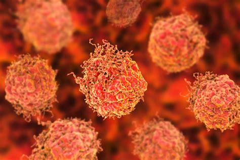 tumor cell type identified   prostate cancer  aggressive