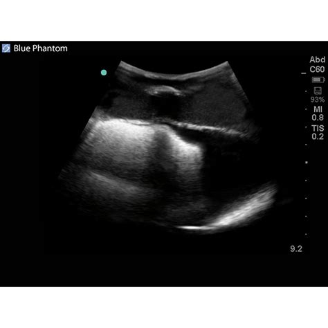 blue phantom midscapular thoracentesis ultrasound training model  blue phantom bpp