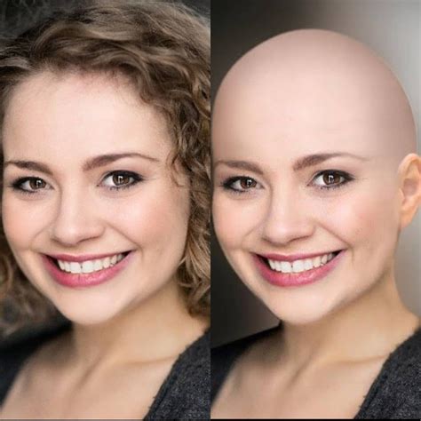 This Is A Before And After Of Carriehopefletcher Before With Her And
