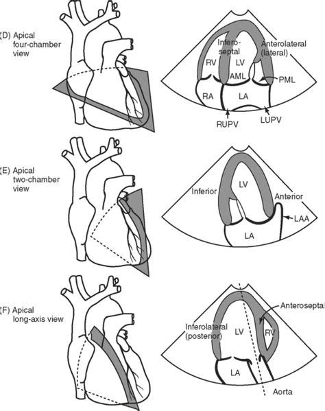 10 Cardiac Views Ultrasound Ideas Ultrasound Cardiac Diagnostic