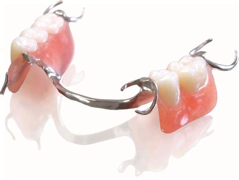 affordable dentures  roseville california ace dental