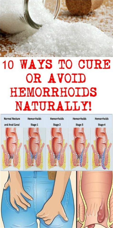 Pin By Beth Villines On General Home Remedies For