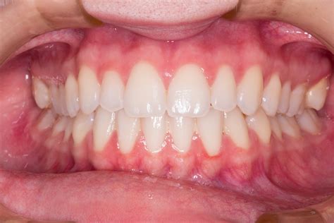 types  teeth   function shervin  louie dds