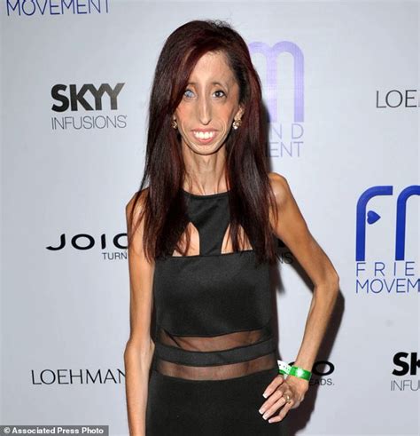‘i know what it is to be bullied how ‘world s ugliest woman lizzie