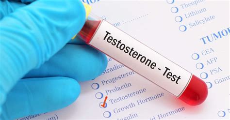 what are normal testosterone levels ages males females and more