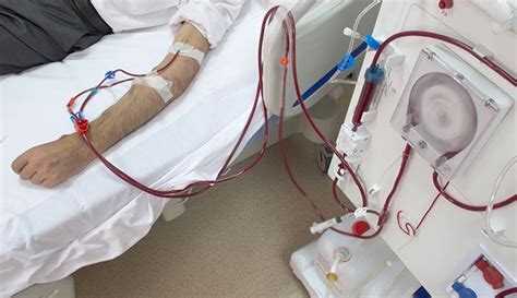 dialysis types   works procedure side effects