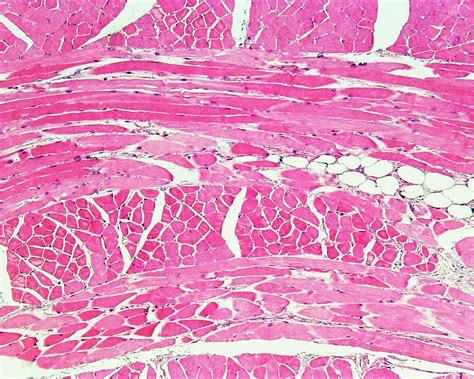 skeletal muscle tissue histology