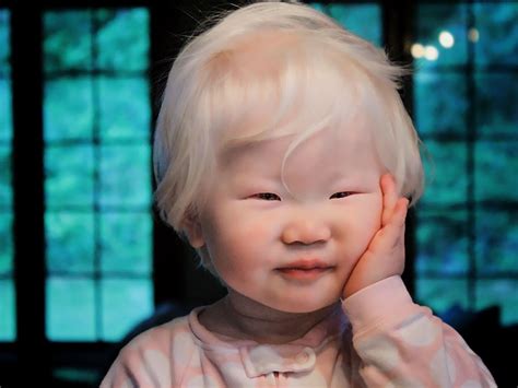 unique beauty  albino people demilked