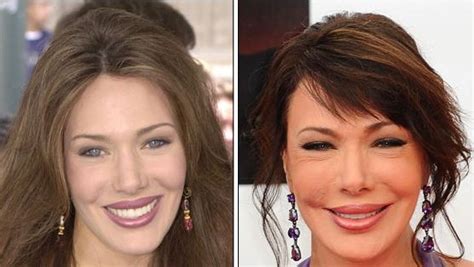 hunter tylo plastic surgery boob jobs facelift nose job and botox injections before and after