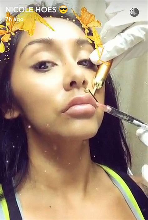 snooki gets botox shares it on snapchat video