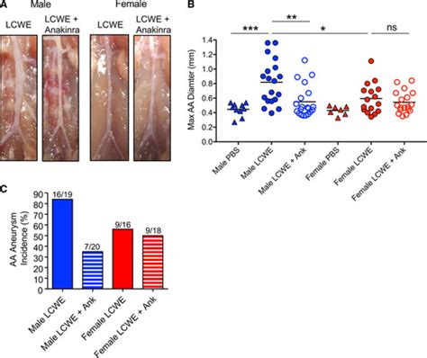 Interleukin 1 Beta Mediated Sex Differences In Kawasaki Disease