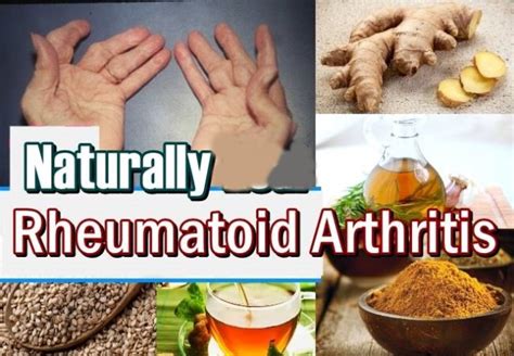 how to treat rheumatoid arthritis naturally fibromyalgia women