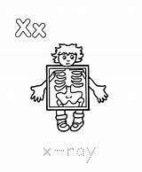 Ray Coloring Drawing Kids Xray Pages Kindergarten Template Getdrawings Easy Popular Clip Library Clipart Coloringhome sketch template