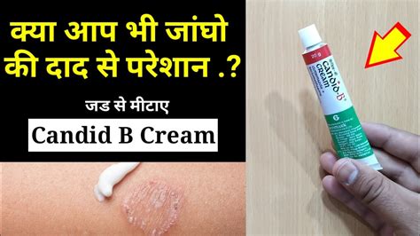 candid b cream for itching rashes and fungal infections uses and