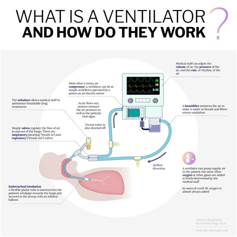 ventilator     work ventilator diagram