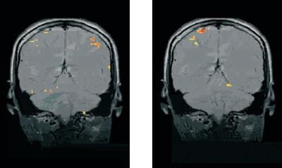 hersenscan als leugendetector nederlands tijdschrift voor geneeskunde