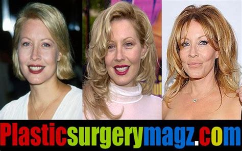 Linda Kozlowski Plastic Surgery Before And After Linda