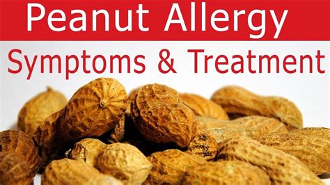 peanut allergy  reaction signs symptoms treatment