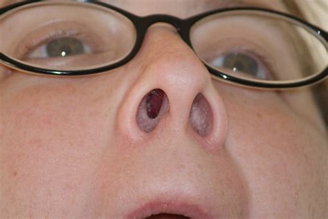 human nose bradley gordon flickr