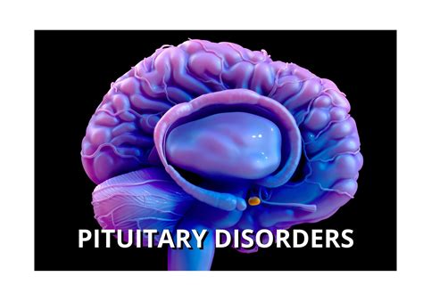 pituitary disorders district endocrine