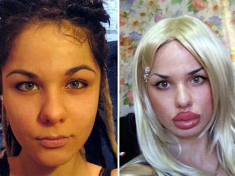 Plastic Surgery Gone Wrong ~ Damn Cool Pictures