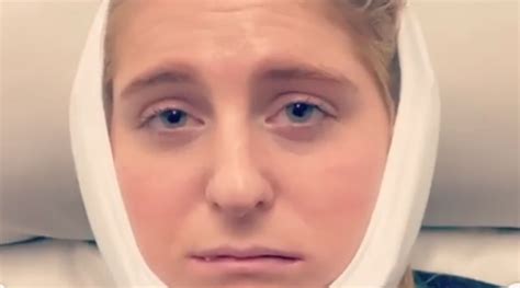meghan trainor gets her wisdom teeth removed watch the hilarious