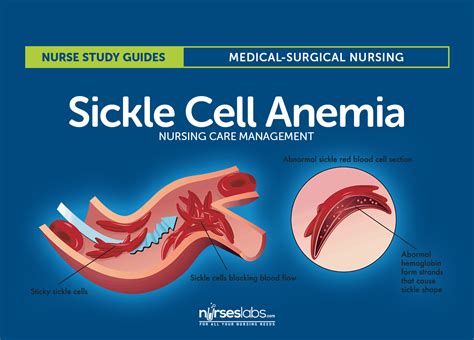 sickle cell anemia nursing care  management study guide