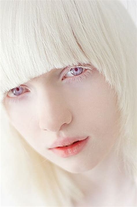 pin en albinos
