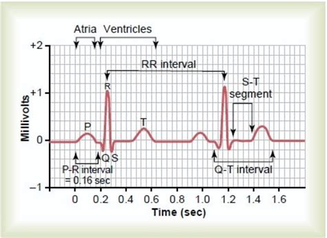 How To Read A Normal Ecg Electrocardiogram Hubpages