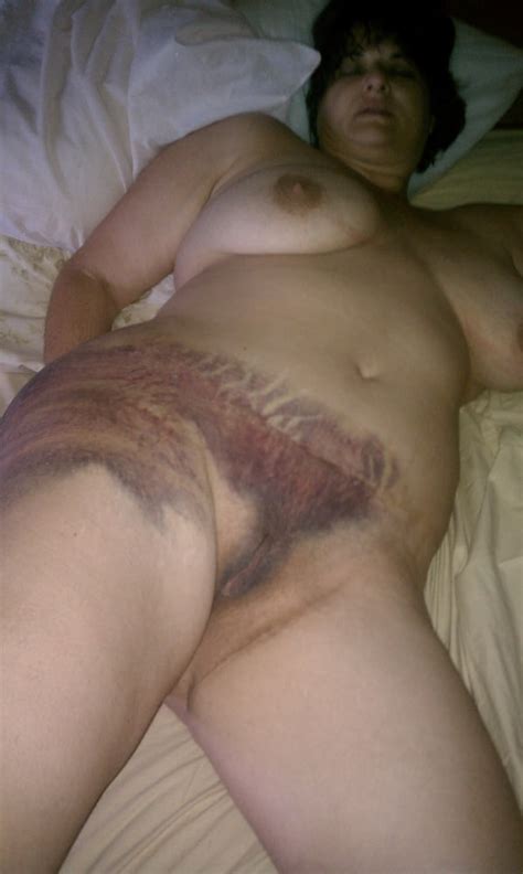 Slutwife Terry Webb Extreme Torture 46 Pics Xhamster