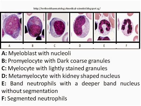 immature granulocytes  pbfs  myeloblast background information