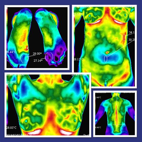 thermography services thermography  health  york