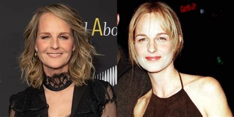 Has Helen Hunt Had Plastic Surgery See Her Face Before