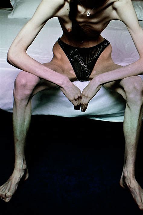 thinspiration portraits shine light on disturbing online proana community