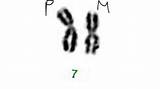 Chromosome Nomenclature sketch template