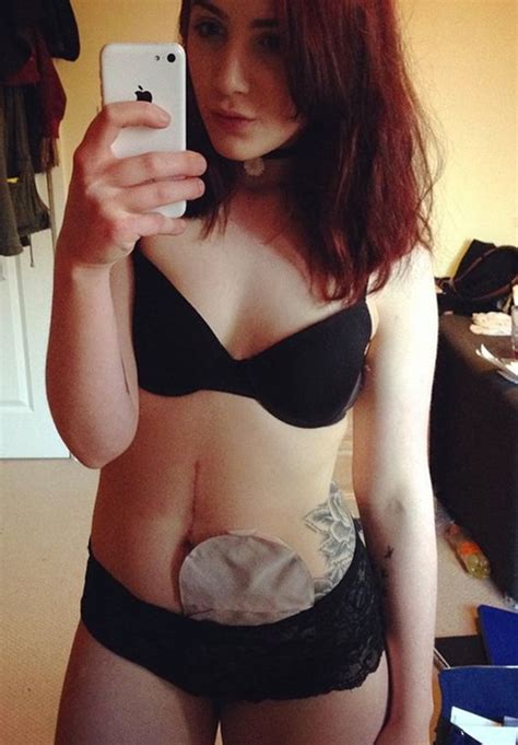 selfies sex and bikinis meet the brave girl enjoying a normal teenager s life despite having