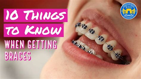 10 Things To Know When Getting Braces Dental Clinic