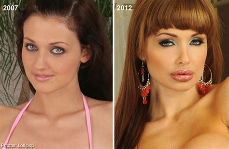 plastic surgery   actress      years