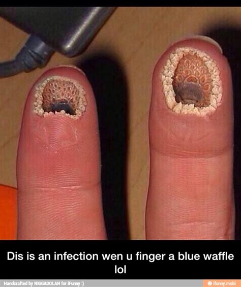 Learning How To Inform What Does Blue Waffle Look Like